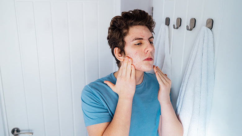 3 cosas que todo adolescente necesita en su rutina de cuidado de la piel image