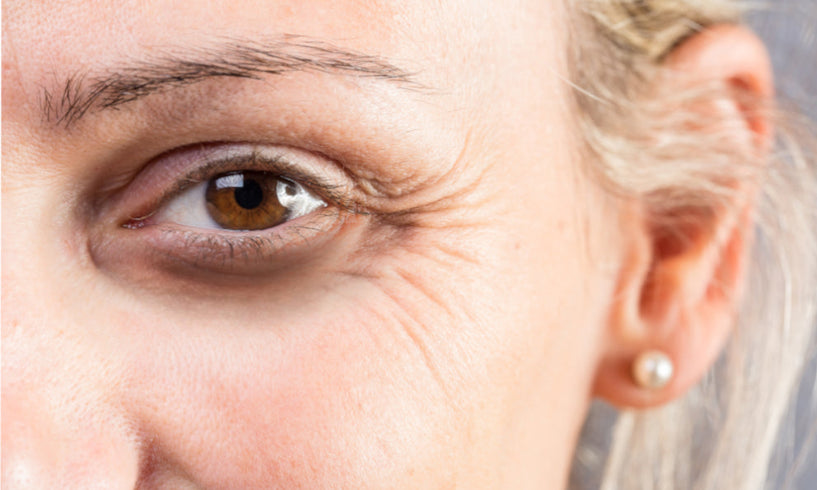 How to relieve tired, puffy eyes naturally image